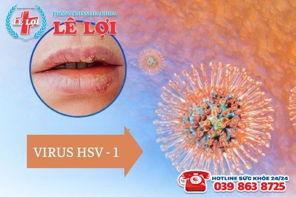 Mụn rộp ở môi do virus HSV gây ra