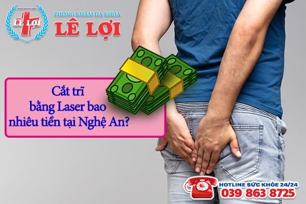 Cắt trĩ bằng laser bao nhiêu tiền tại Nghệ An?
