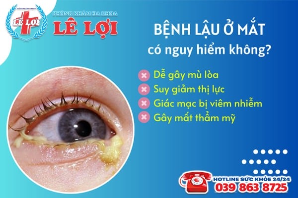 Bệnh lậu ở mắt có nguy hiểm không?