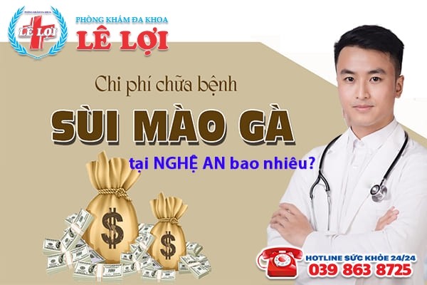 Chi phí điều trị sùi mào gà tại Nghệ An bao nhiêu tiền?