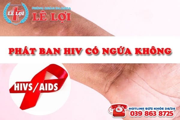 Phát ban HIV có ngứa không – dấu hiệu nhận biết?