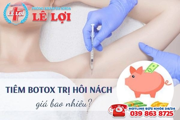 Tiêm botox trị hôi nách giá bao nhiêu tại bệnh viện Nghệ An?