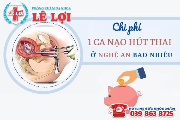 Chi phí 1 ca nạo hút thai ở Nghệ An khoảng bao nhiêu