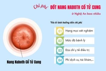Ước tính chi phí đốt nang naboth cổ tử cung ở Nghệ An