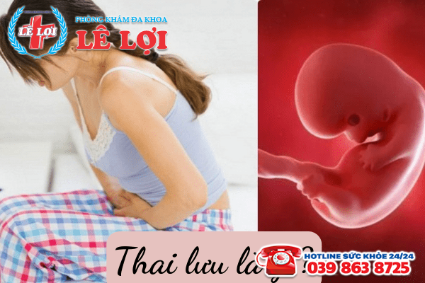 Thai lưu là gì? Nguy hiểm như thế nào?