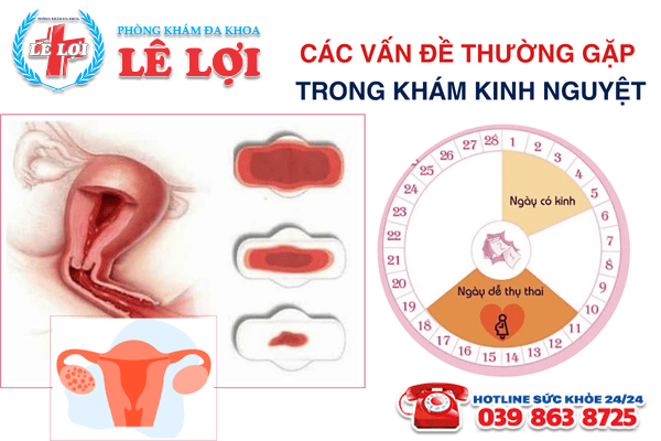 Các vấn đề thường gặp trong khám kinh nguyệt