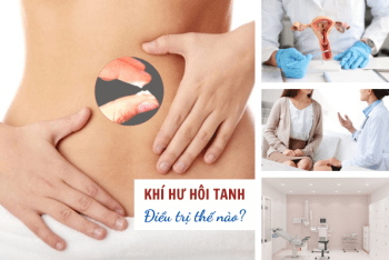 Khí hư hôi tanh: Điều trị thế nào?