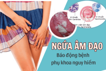 Ngứa âm đạo: Báo động bệnh phụ khoa nguy hiểm