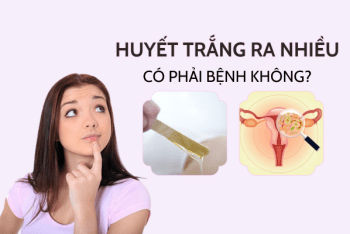 Huyết trắng ra nhiều có phải bệnh không?