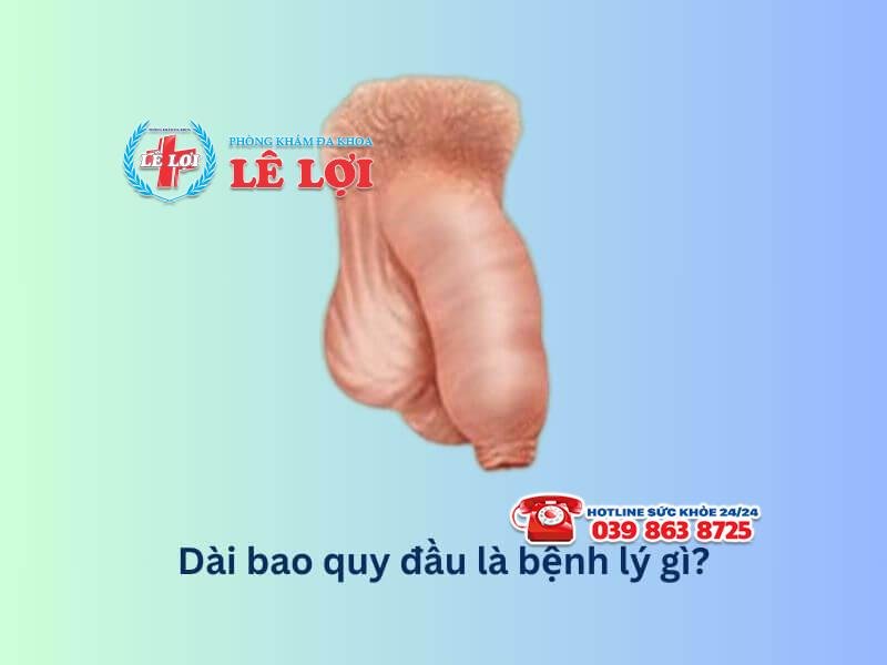 Chọn phòng khám chữa dài bao quy đầu ở Vinh Nghệ An uy tín